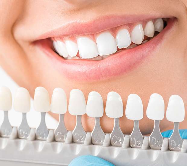 Tucson Cosmetic Dentist