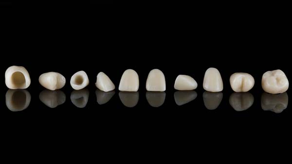 Understanding Dental Crowns Versus Veneers