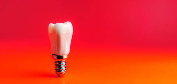 Ways To Extend The Life Of Dental Implants