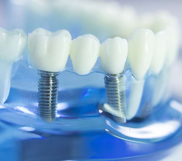 Tucson Dental Prosthetics