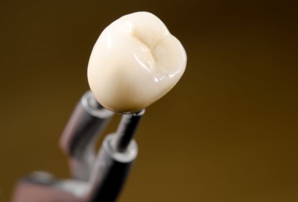 A Guide To Your Dental Crown Procedure