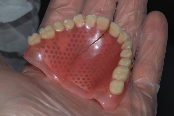 Denture Repair For A Better Fit