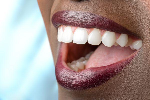 How To Improve Your Smile With A Full Mouth Reconstruction
