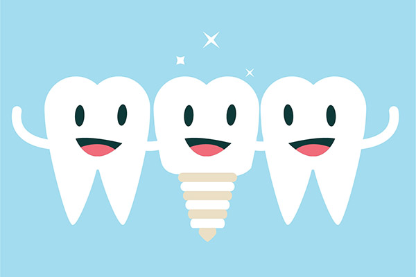 Implant Dentistry Aftercare FAQs from Simply Smiles Dentistry in Tucson, AZ