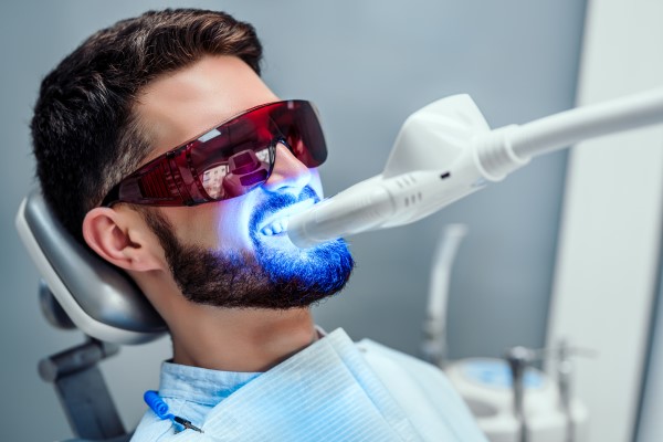 How Long Will Teeth Whitening Take Home Trays Results Last?